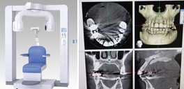3DXマルチイメージマイクロCT