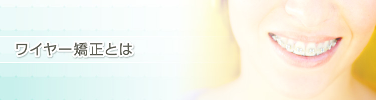 ワイヤー矯正とは